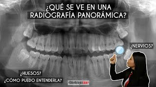 ¿Qué se ve en una radiografía panorámica ¿Cómo puedo entenderla 🦷  Odontología Láser [upl. by Zaneta]