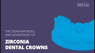 Zirconia Dental Crowns  Disadvantages and Advantages [upl. by Lusa333]