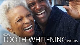 How Tooth Whitening Works [upl. by Asilenna]