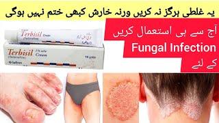 Terbisil Cream Uses in urdu  How to use Terbisil Cream Dr Rida Ahmed [upl. by Manus]