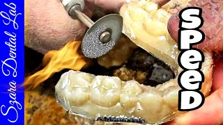 How to Finish Clear Retainers 3 tips Part 2 by Szara Dental [upl. by Yendic]