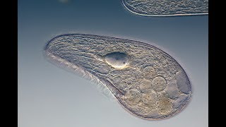 Microbiology of Eukaryotes Protozoa [upl. by Christean]