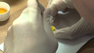 How to Make a Zirconia Crown [upl. by Niwdla593]