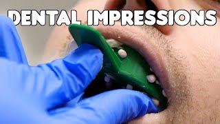 Dental Impressions amp Pouring Teeth Models [upl. by Dayna]