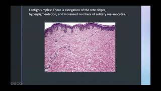 Benign pigmented and melanocytic lesions [upl. by Rola]