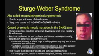 SturgeWeber Syndrome [upl. by Aleck]