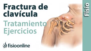 FRACTURA de CLAVÍCULA Rehabilitación ejercicios y tiempo de RECUPERACIÓN [upl. by Ettenaj]