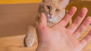 CAT SCRATCH DISEASE  BARTONELLA HENSELAE  Causes Symptoms Treatment Prevention Pathology [upl. by Yazbak868]