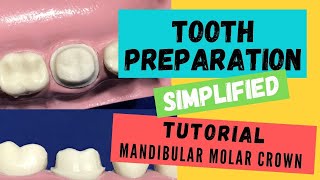 Zirconia Crown Preparation DEMONSTRATION Super Simplified [upl. by Yadrahs648]