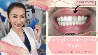 How to treat a discolored or dark tooth  zirconia crown [upl. by Zerk]