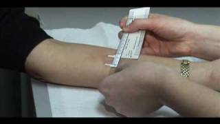 TB Skin Test  Mantoux Method [upl. by Chapel298]