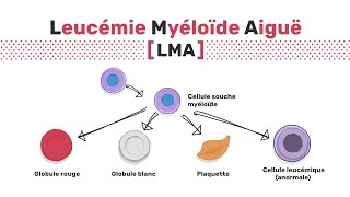 Types de leucémie myéloïde aiguë [upl. by Casteel223]