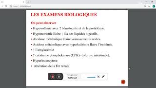 les occlusion intestinale aigue [upl. by Myra]