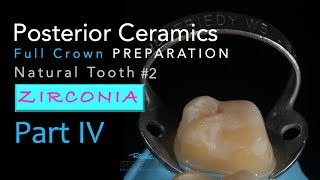 Zirconia Ceramics Part 4 AllCeramic Crown Preparation 2 Natural Tooth [upl. by Doone]