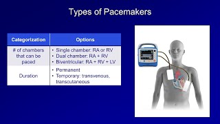 An Introduction to Pacemakers [upl. by Plank]