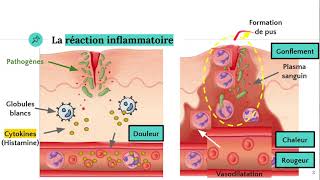 La réaction inflammatoire 🔥 [upl. by Ys]