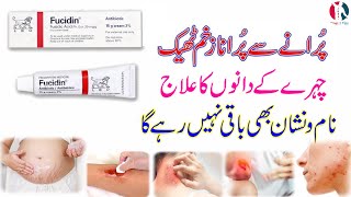 fucidin topical cream  fucidin cream  fucidin h cream uses in urdu  fucidin acid  how to use [upl. by Enrico]