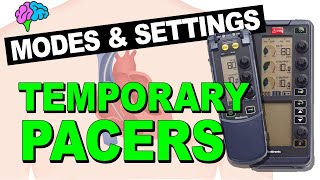 Temporary Pacemakers  Modes and Basic Settings [upl. by Woodhead725]